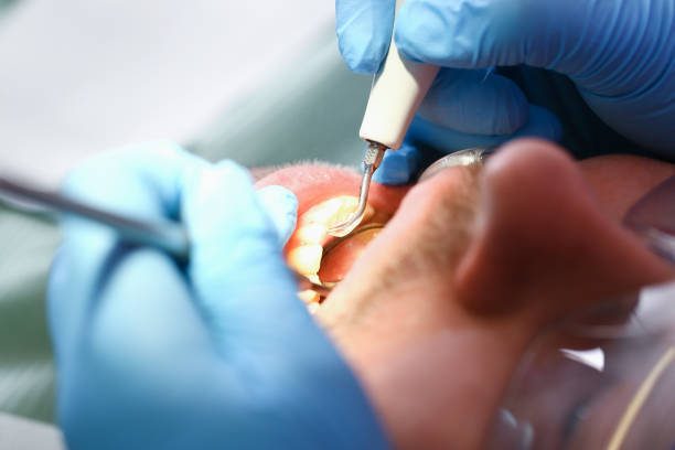Best Emergency Dental Care for Broken or Chipped Teeth in La Vergne, TN