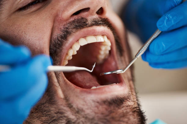 Best Urgent Care for Lost Fillings or Crowns in La Vergne, TN